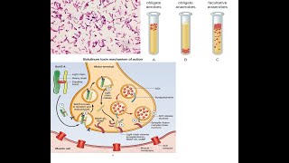 Clostridium botulinum Part 2 Mechanism of action of botulinum toxin symptoms diagnosis treatment [upl. by Tychonn]