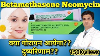 Betnovate N cream  Betamethasone Neomycin cream  betnovate n skin cream [upl. by Anod]