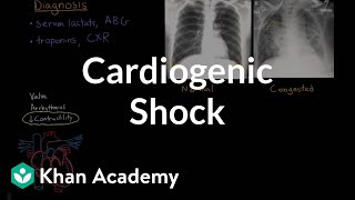 Cardiogenic shock  Circulatory System and Disease  NCLEXRN  Khan Academy [upl. by Garbers]