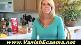 Beating Food Allergy Related Eczema With Eczema Gone [upl. by Eimmas]