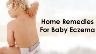 How to Get Rid of Eczema  Home Remedies For Baby Eczema [upl. by Tnahs]