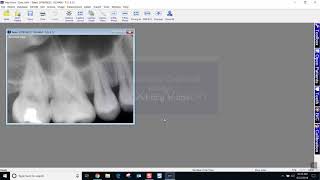 Training Apteryx XrayVision 4 Acquiring a Single Image [upl. by Grizel]