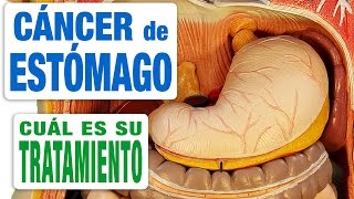 Cáncer de Estómago  Tratamiento [upl. by Semmes]