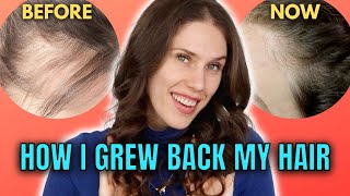 10 Best amp Worst Hair Growth Treatments That I’ve Tried At Home [upl. by Llirred]