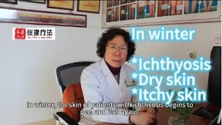 In winter the skin of ichthyosis patients begins to peel and itch againichthyosisskincaredryskin [upl. by Mcripley787]