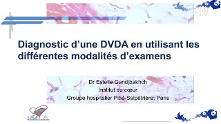 DVDA comment en faire le diagnostic [upl. by Aowda47]