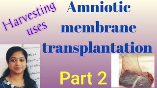 Amniotic membrane transplantation Methods of harvestinguses of Amniotic membrane in ophthalmology [upl. by Camroc]