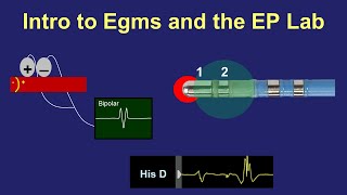 Intro to Intracardiac Electrograms amp the EP Lab [upl. by Bakeman]