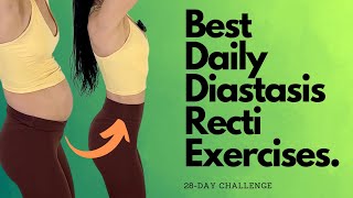 Heal amp Flatten With These Daily Diastasis Recti Exercises [upl. by Annairt]