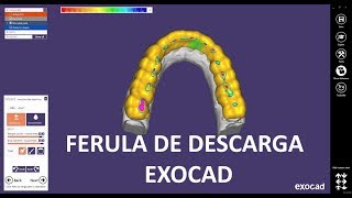 Ferula de descarga con exocad [upl. by Mamie]