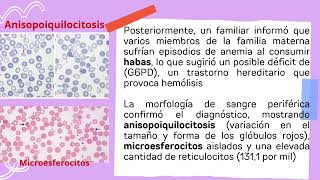 CASO CLÍNICO ANEMIA HEMOLÍTICA [upl. by Genie]