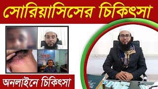 সোরিয়াসিস রোগের চিকিৎসা  সোরিয়াসিস রোগের লক্ষণ  সোরিয়াসিস থেকে মুক্তির উপায় Psoriasis Patient [upl. by Lloyd]