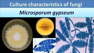 Microsporum gypseumClear over view about Colony morphology [upl. by Yemirej768]