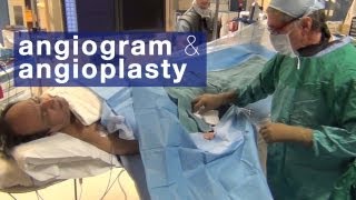 Angiogram amp angioplasty what to expect [upl. by Alletsirhc]