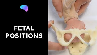 Types of Fetal Positions  OSCE Guide  UKMLA  CPSA [upl. by Geffner]