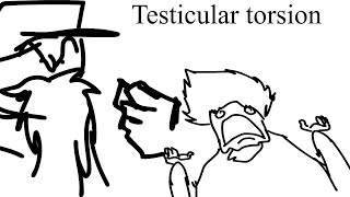 Testicular torsion [upl. by Eltsyrc239]