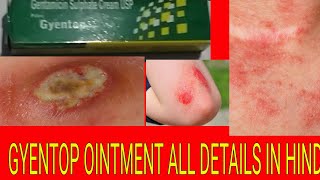 GYENTOP OINTMENT IN HINDI  ALL DETAILS GYENTOP OINTMENT IN HINDI [upl. by Eutnoj]