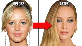 Jennifer Lawrences Plastic Surgeries The High Cost of Perfection [upl. by Clarey111]