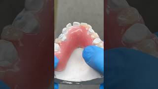 Removable Process Partial lsk121shorts dentist teeth [upl. by Norod185]