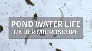 Pond water microorganism under microscope [upl. by Mclain474]