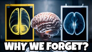 The UNEXPECTED TRUTH about why we forget things [upl. by Peggie]