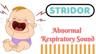 STRIDOR  Audible Respiratory sound [upl. by Mount]