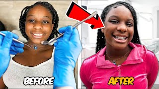 I TOOK MY DAUGHTER CAMARI TO GET BRACES [upl. by Leay458]