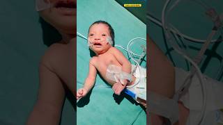 Very sick newborn babynewbornbabybabybornsickviral video [upl. by Held]