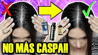 EL MEJOR SHAMPOO PARA LA CASPA  MARIEBELLE COSMETICS [upl. by Nilkoorb198]