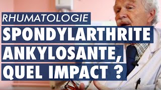 Spondylarthrite ankylosante quel impact pour les patients [upl. by Endaira]