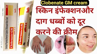 Clobenate GM cream  Clobenate GM cream uses in Hindi  दादखाजखुजली और दाग धब्बों पर असरदार क्रीम [upl. by Ardaid893]