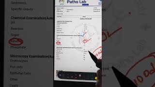 Urine Test In Hindi  Urine Test Report  UrineTest Analysis  Urine Test Report Kaise Dekhehba1c [upl. by Innig]