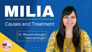 Milia removal treatment  Dermatologist  Skin specialist [upl. by Yeldud514]