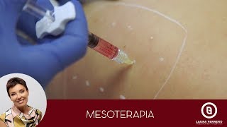 Mesoterapia  Dott Laura Ferrero  Medicina Estetica Torino [upl. by Balthazar]