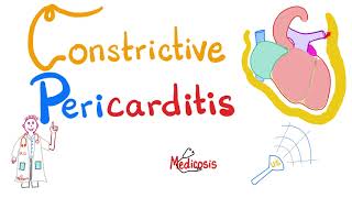 Constrictive Pericarditis  Causes Symptoms Signs Diagnosis amp Management  Cardiology [upl. by Lindblad]