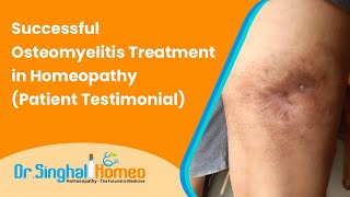 OSTEOMYELITIS CASE TREATED WITH HOMEOPATHY 100 [upl. by Akeemahs]