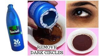 Remove Dark Circles Fast And Overnight  Dark circles under eyes home remedy [upl. by Pernell]