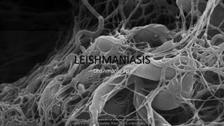 Leishmaniasis MORFOLOGÍA resumen  memorización [upl. by Yeldud899]