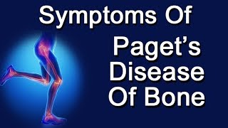 Symptoms Of Pagets Disease Of Bone [upl. by Fairbanks281]