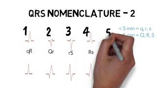 ECG QRS NOMENCLATURE [upl. by Gardener]