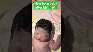 New born baby after birth 😍 🌹✅ ep294 birth childbirth [upl. by Engamrahc]