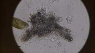 The BlobAmoeba proteus under the microscope [upl. by Acinoed425]