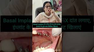 Eating everything after 5 daysBasal implants done for missing molars खाना संभव केवल 5 दिन के [upl. by Goth]