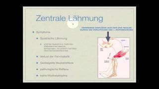 Basiskurs Neurologie Lähmungen Teil 214 [upl. by Oeram]