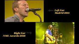 Coldplay vs Coldplay  Do they keep time with themselves live Yellow  Spot the Difference [upl. by Kobylak]