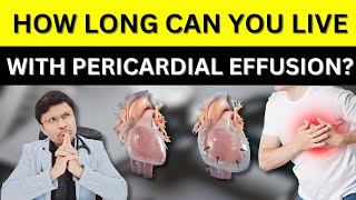 Pericardial Effusion Causes Symptoms Diagnosis amp Treatment PERICARDIALEFFUSION [upl. by Atnuhs]