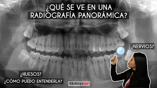 ¿Qué se ve en una radiografía panorámica ¿Cómo puedo entenderla 🦷  Odontología Láser [upl. by Ametaf]