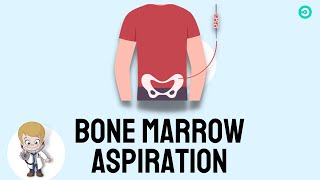 Bone marrow Aspiration and Biopsy Procedure explained [upl. by Arihday]