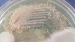 Moraxella lacunata  Pitted colonies [upl. by Coughlin968]