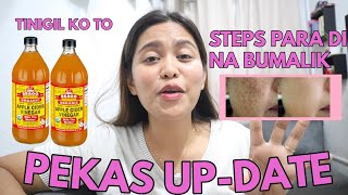 PEKAS O MELASMA UPDATE SECRET PARA DI NA BUMALIKTINIGIL KO NA ANG APPLECIDER VINEGAR [upl. by Yurt]